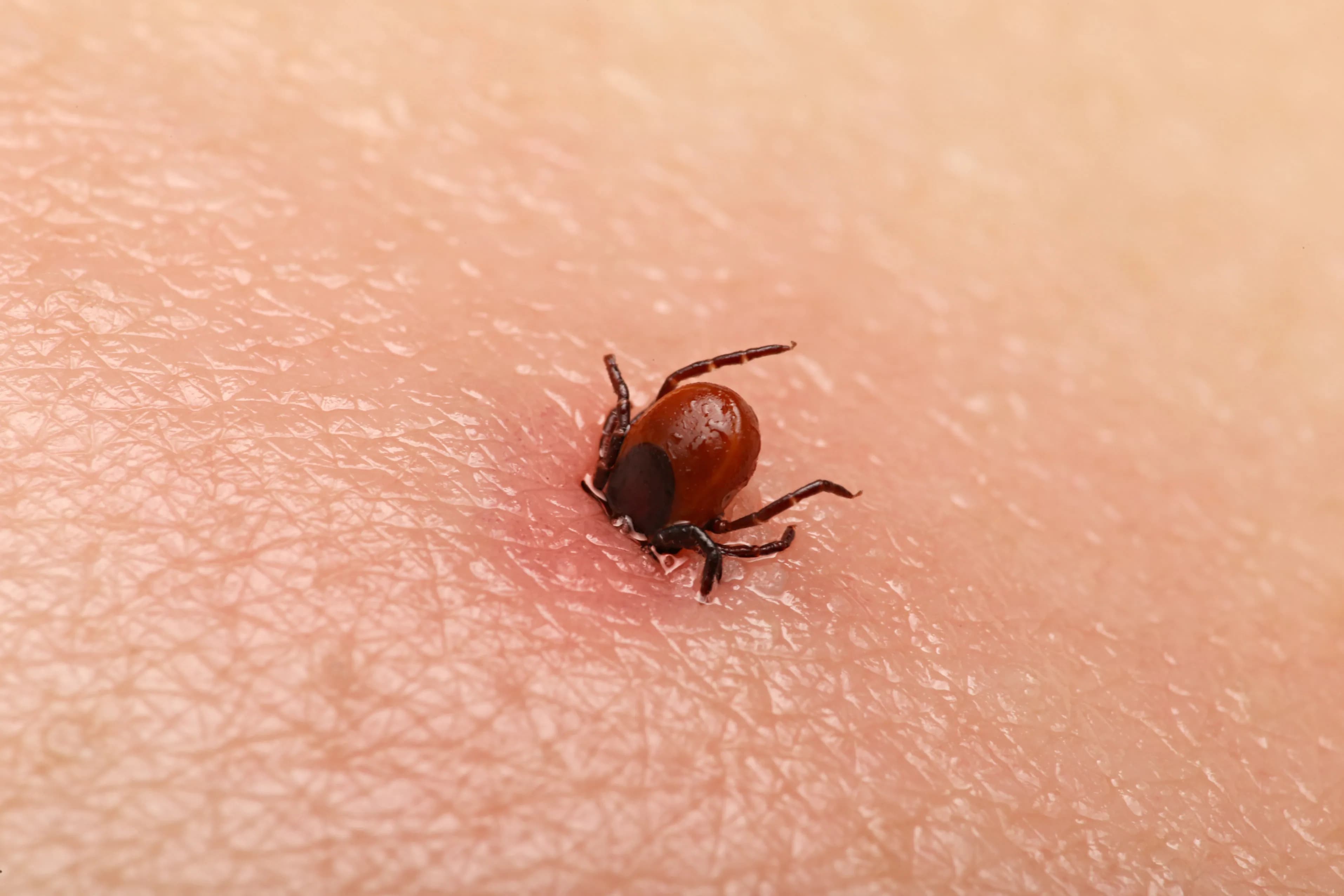Hướng dẫn toàn diện về phòng ngừa vết cắn của ve và bệnh Lyme